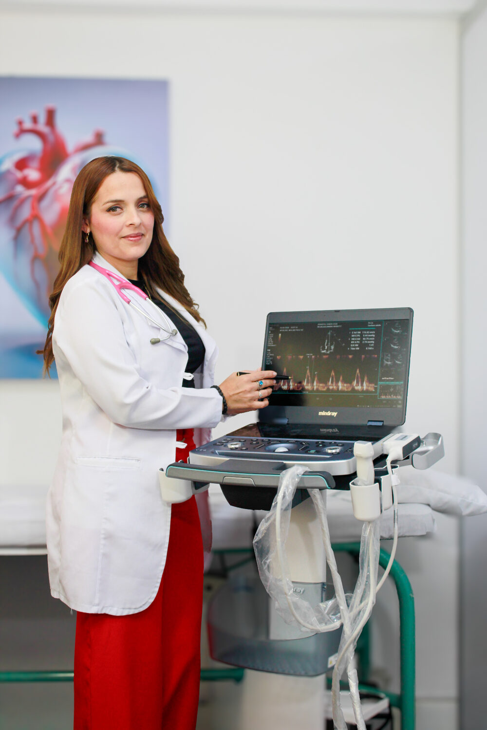 Ecocardiograma Doppler